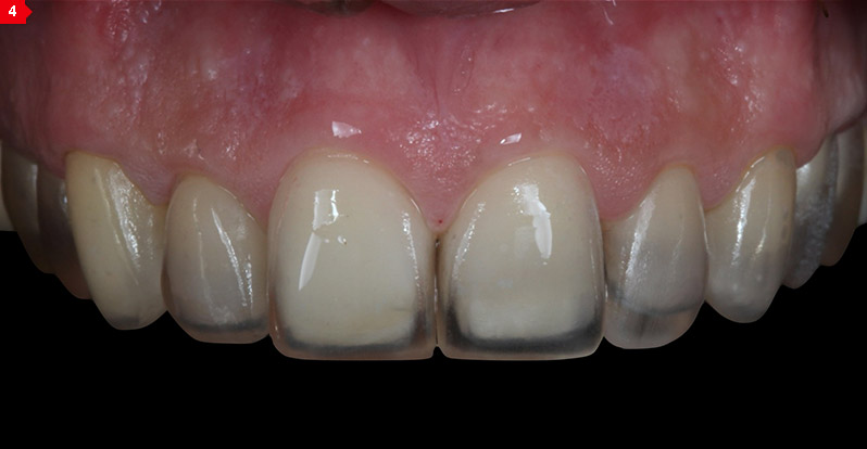 CENTRE - Tratamentos Odontológicos