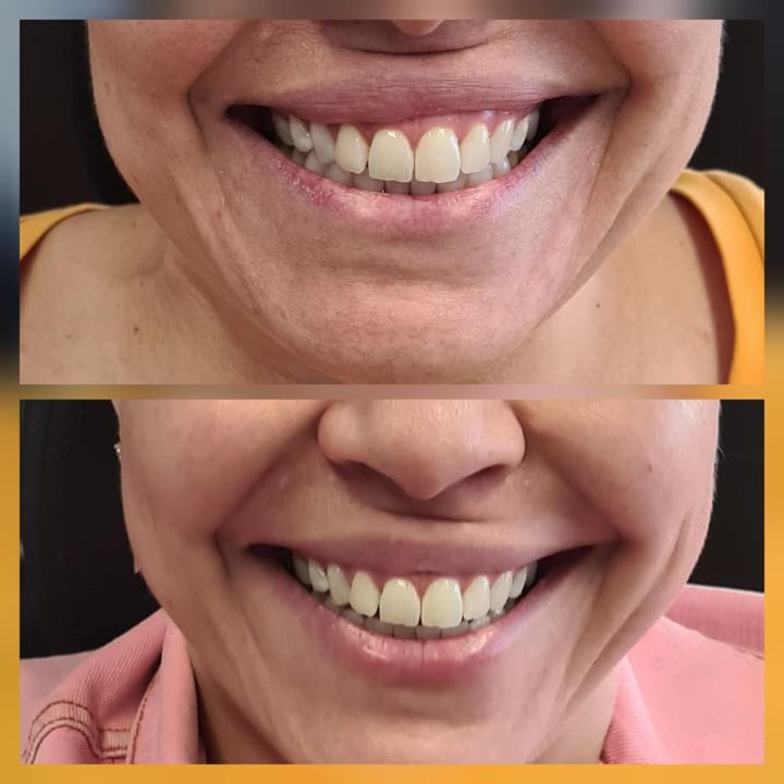 Neolago Estética Facial e Odontologia - foto 4