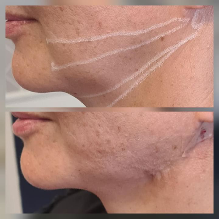 Neolago Estética Facial e Odontologia - foto 2