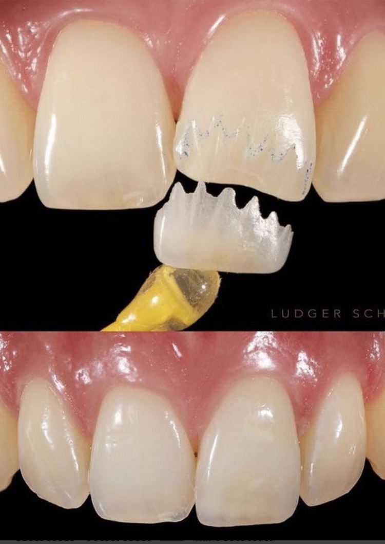 DENTISTA NITERÓI - Dr. Wanderson Lugão Clínica CEIO - centro especializado em implantes e ortodontia - foto 2