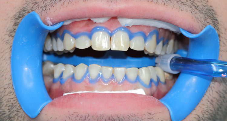 ALINHADORES FORTALEZA - foto 4