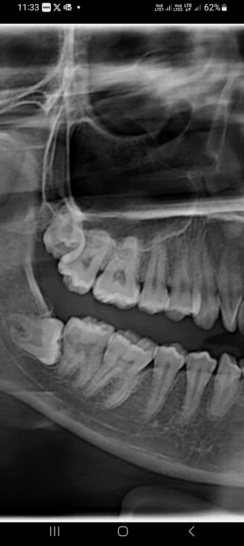 Appu Dental Clinic