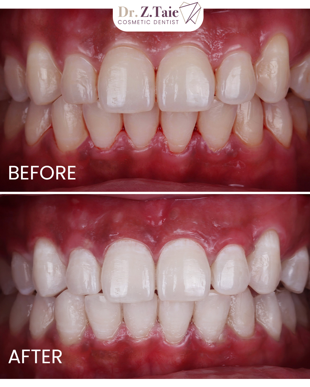 Dentist Zeinab Taie (Dubai - Marina) 3