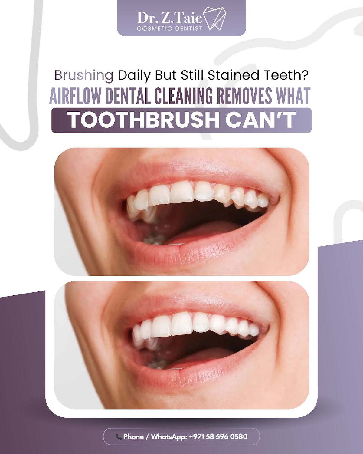Dentist Zeinab Taie (Dubai - Marina) 4