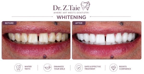 Dentist Zeinab Taie (Dubai - Marina) 5