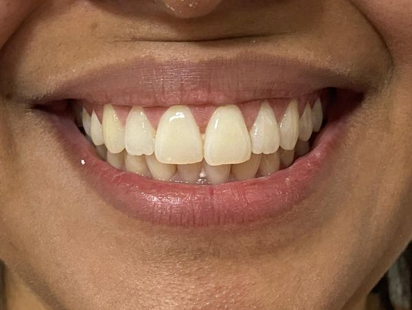 Dra. Vanessa Tonetto - Dentista | Implante Dentário | Alinhadores Invisalign | Lente de Contato Dental | Ribeirão Preto - foto 1