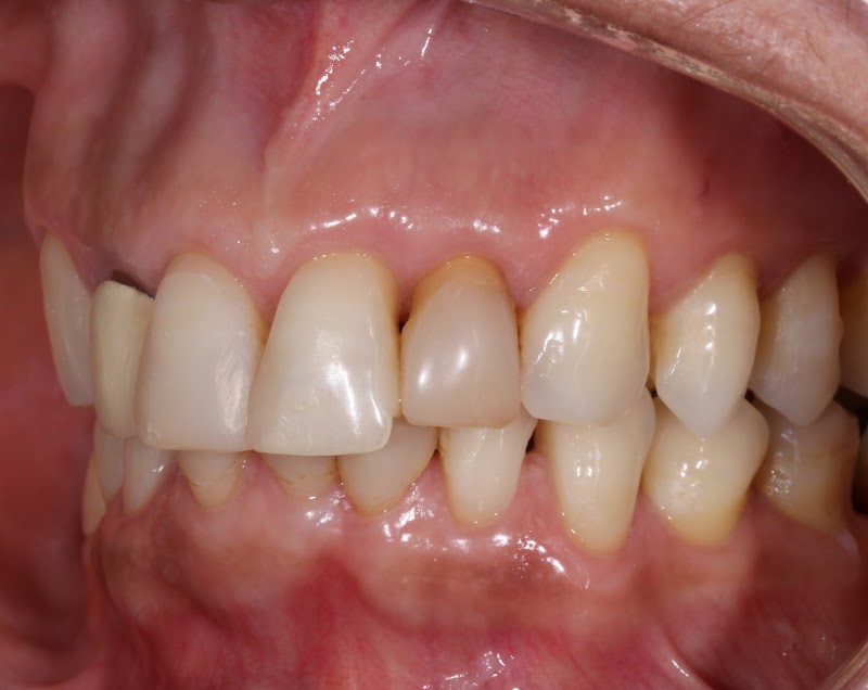 Dra. Francielle A. | Endodontia | Endodontista | Tratamento de canal BH | Dentista BH - foto 5