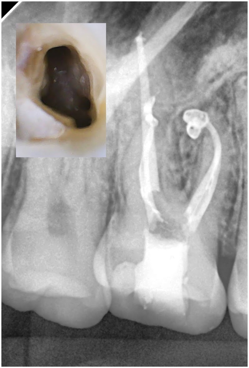 Dra. Francielle A. | Endodontia | Endodontista | Tratamento de canal BH | Dentista BH - foto 2