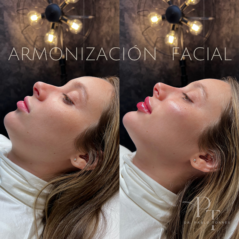 Dr. Pablo Torres | Aumento de Labios en Vigo photo 3