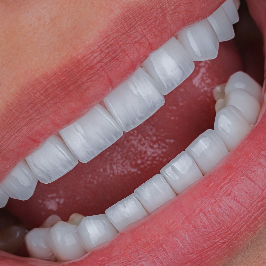 Esthetic Dubai ( La Maison Des Sourires ) 4