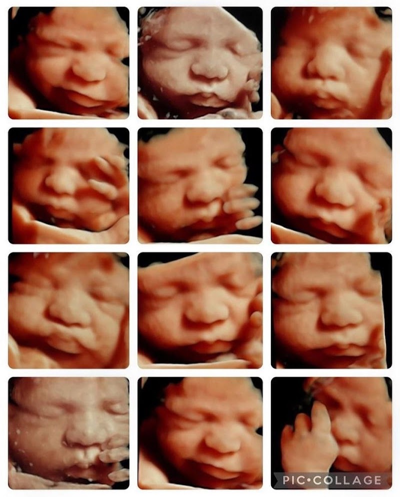 Goldenview Ultrasound 3d/4d/HD Chicago