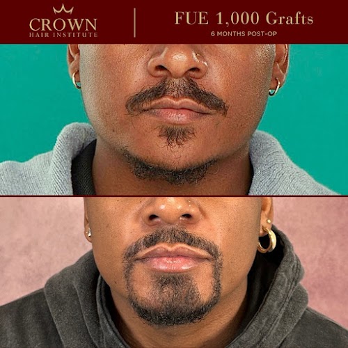 Crown Hair Institute logo