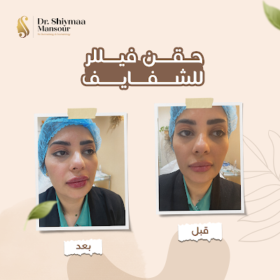 الدكتورة شيماء منصور | جلدية وتجميل وليزر بجدة