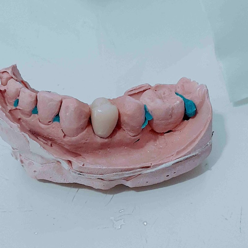 Instituto Damião Odonto/Implantes/Harmonização Facial/Invisalign/Lentes de Contato- Vitória-ES - foto 4