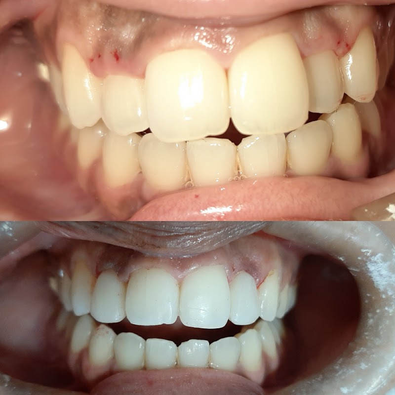 Instituto Damião Odonto/Implantes/Harmonização Facial/Invisalign/Lentes de Contato- Vitória-ES - foto 2
