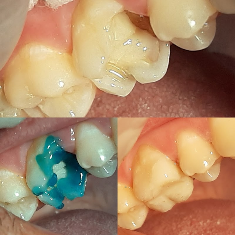 Instituto Damião Odonto/Implantes/Harmonização Facial/Invisalign/Lentes de Contato- Vitória-ES