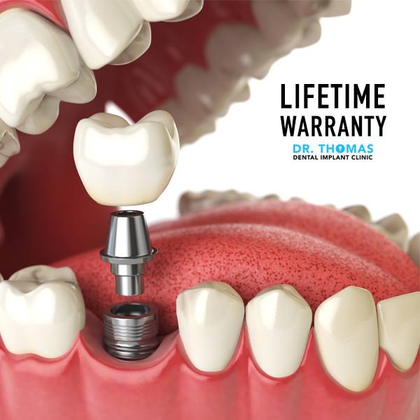 Dr. Thomas Dental Implant Clinic