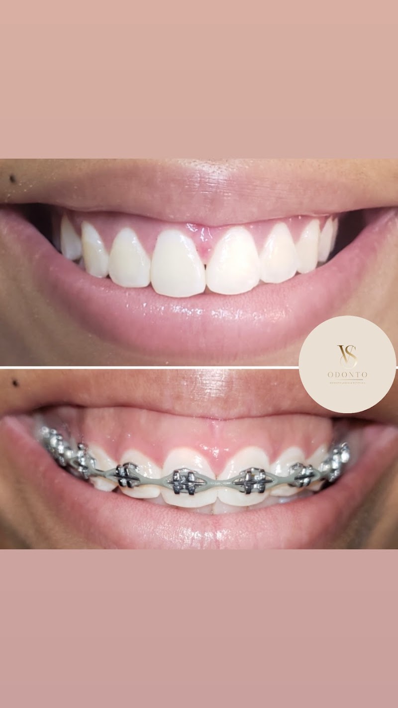 VS Odonto - Odontologia&Estética - foto 4