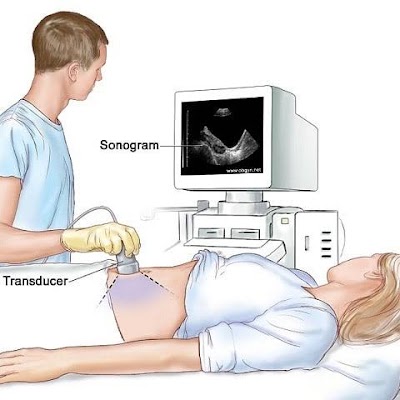 Ramthakur sonography Centre - Image 3