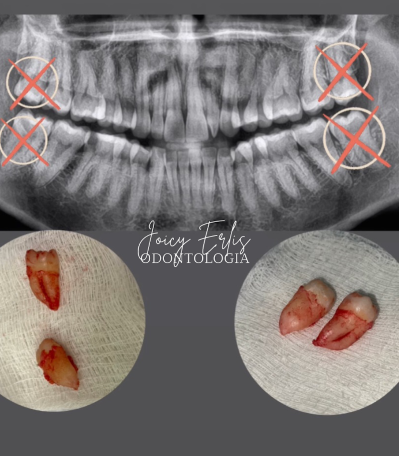 Dra. Joicy Erlis - Dentista 24h - foto 5