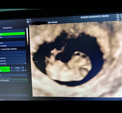 Precious fertility and IVF centre - Image 3