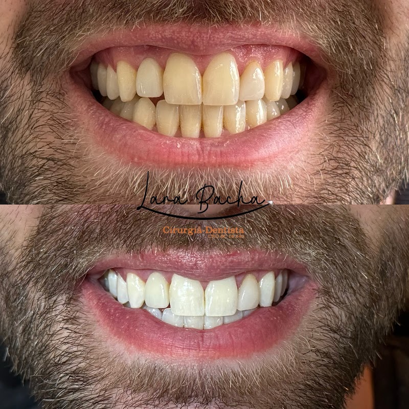 Dra. Lara Bacha Cirurgiã-Dentista