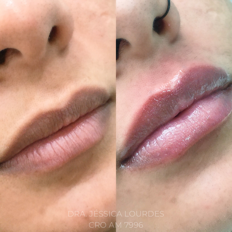 Dra. Jessica Lourdes, Dentista - foto 4