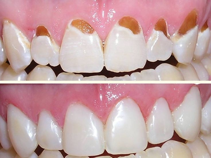 Odontoméier - foto 2