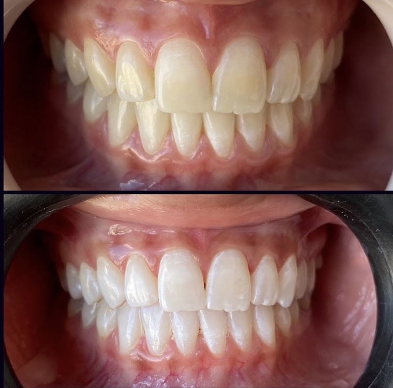 You Clareamento Dental Manaíra | Dentista em João Pessoa PB - foto 2