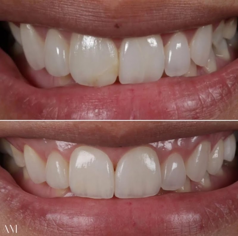 Dra Alessandra Mendonça - Odontologia Estética e Reabilitadora