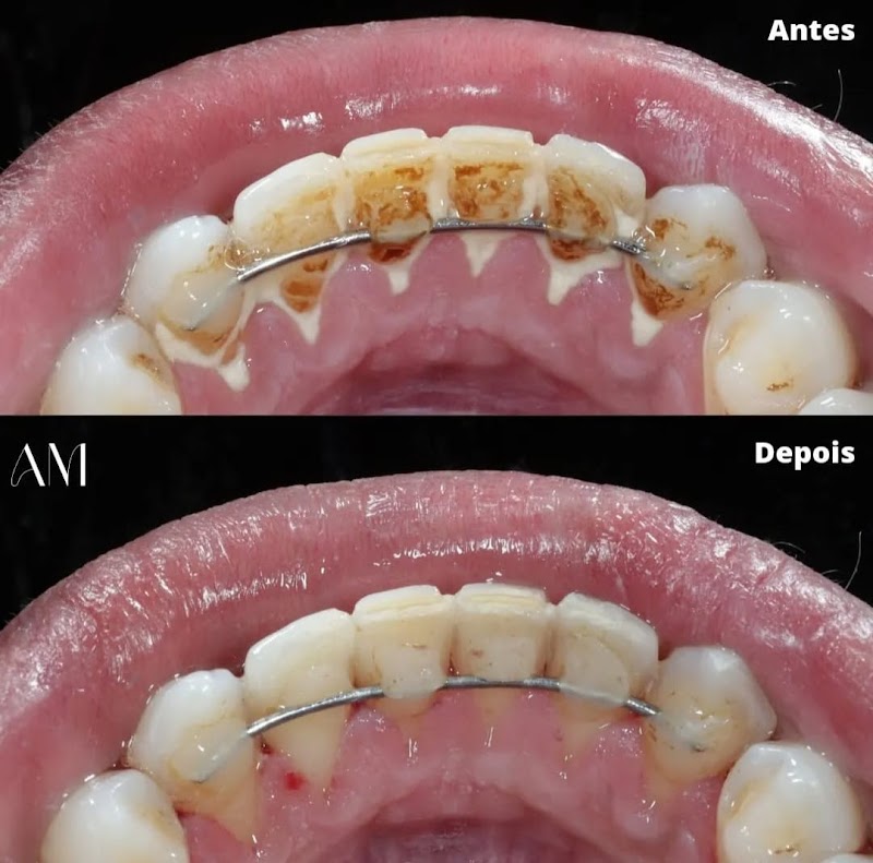 Dra Alessandra Mendonça - Odontologia Estética e Reabilitadora - foto 5
