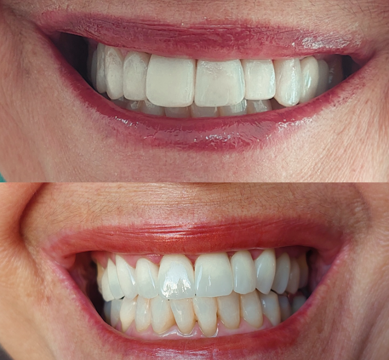 Inova Odontologia - Referência Em Reabilitação Oral - foto 3