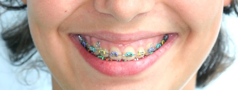 Clínica de Ortodoncia Carolina Méndez photo 4