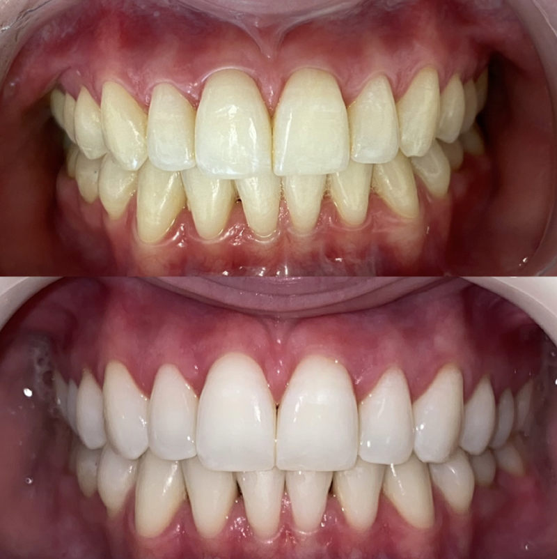 Odontologia Especializada Dr. Flávio Cunha e Dra. Letícia Feix Cunha | Dentista Menino Deus | Implante Dentário | Invisalign - foto 2