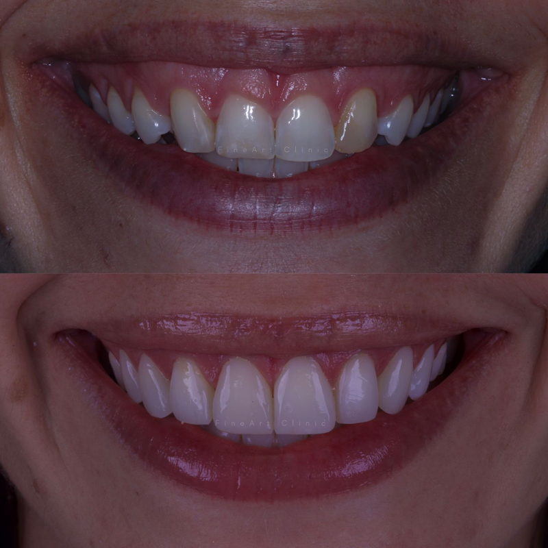 Dra. Aline Trombini - foto 4