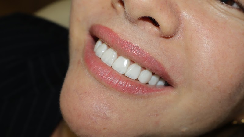 Mesh Odontologia Estética | Facetas em Fortaleza - foto 5