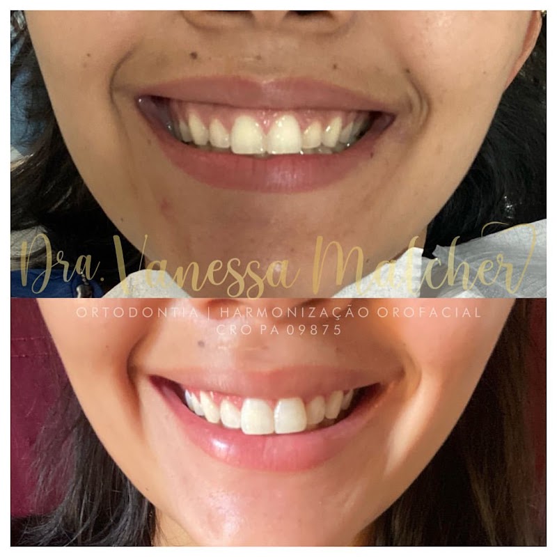 Dra Vanessa Malcher - Implantes e Harmonização Facial em Manaus - foto 5