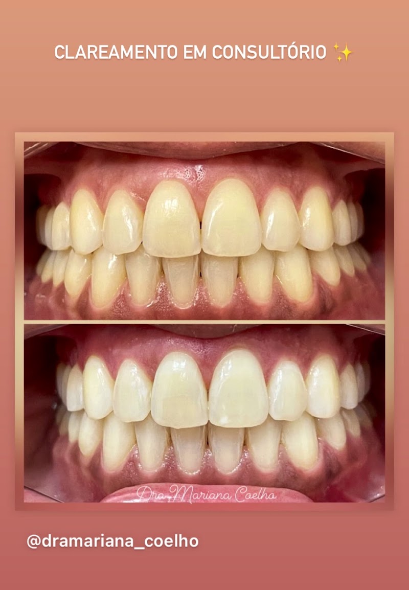 Dra Mariana Coelho/Ortodontia Especializada - foto 4