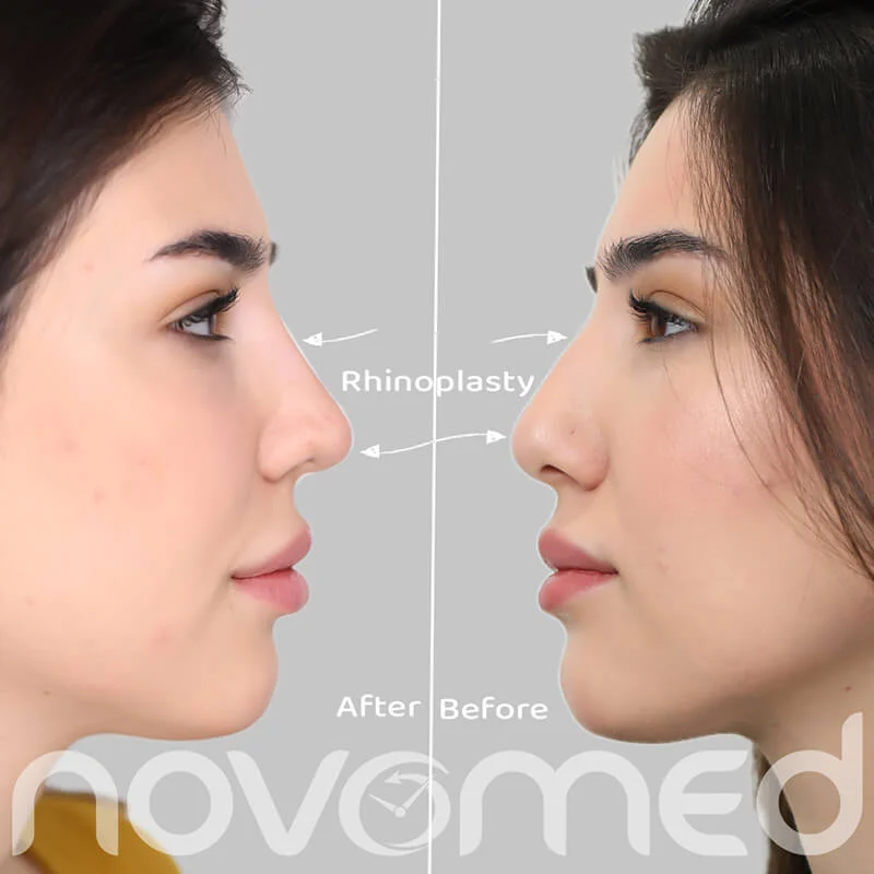 Novomed 4