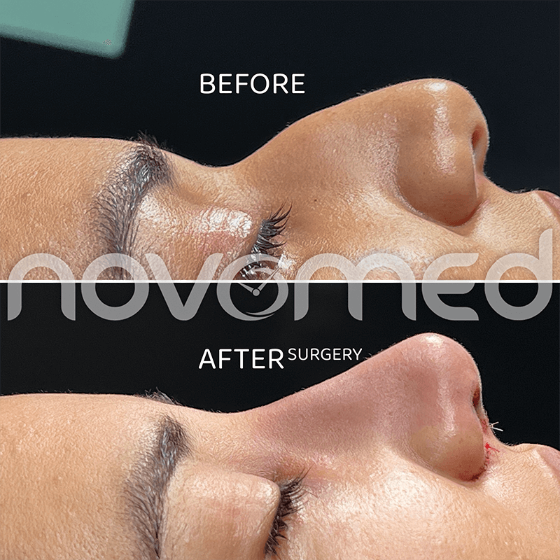Novomed 2