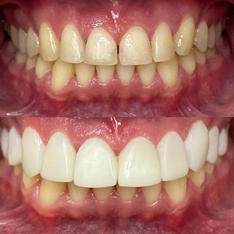 Dra. Daniela Carvalho | Dentista, Facetas de Resina, Clareamento Dental.