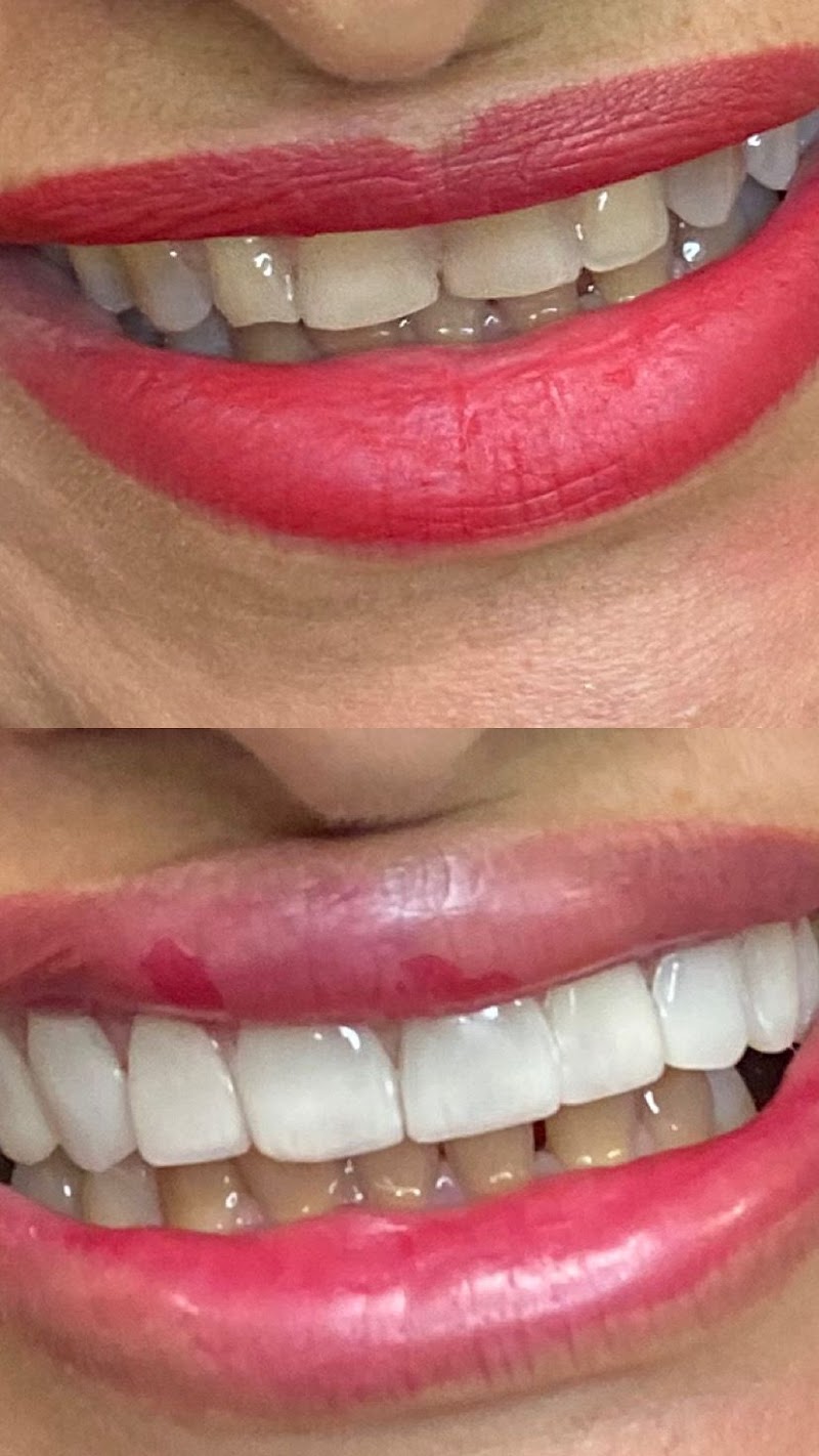 Dra. Daniela Carvalho | Dentista, Facetas de Resina, Clareamento Dental. - foto 5