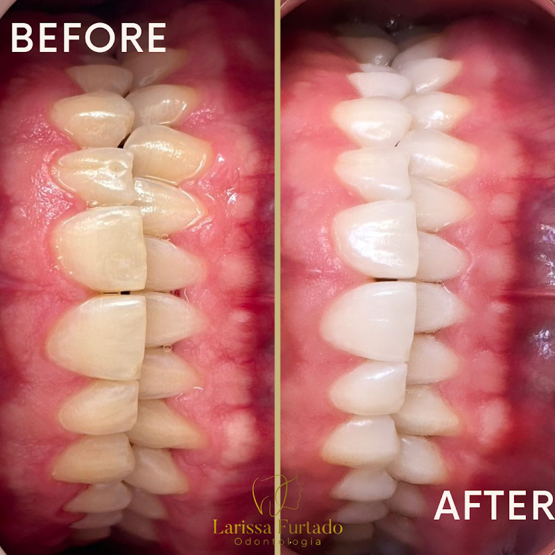 Dra Larissa Furtado | harmonização facial Petrópolis - foto 3