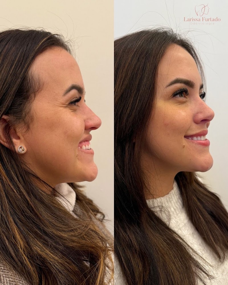 Dra Larissa Furtado | harmonização facial Petrópolis - foto 4