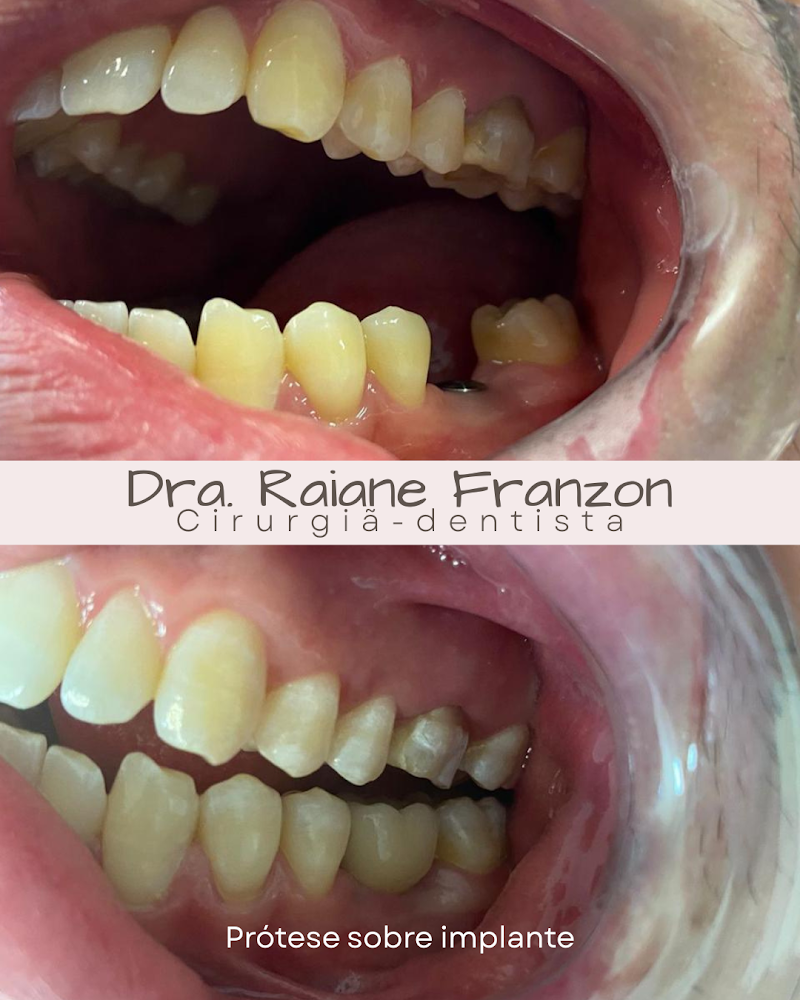 Consultório Odontológico - Dra. Raiane Franzon - foto 3
