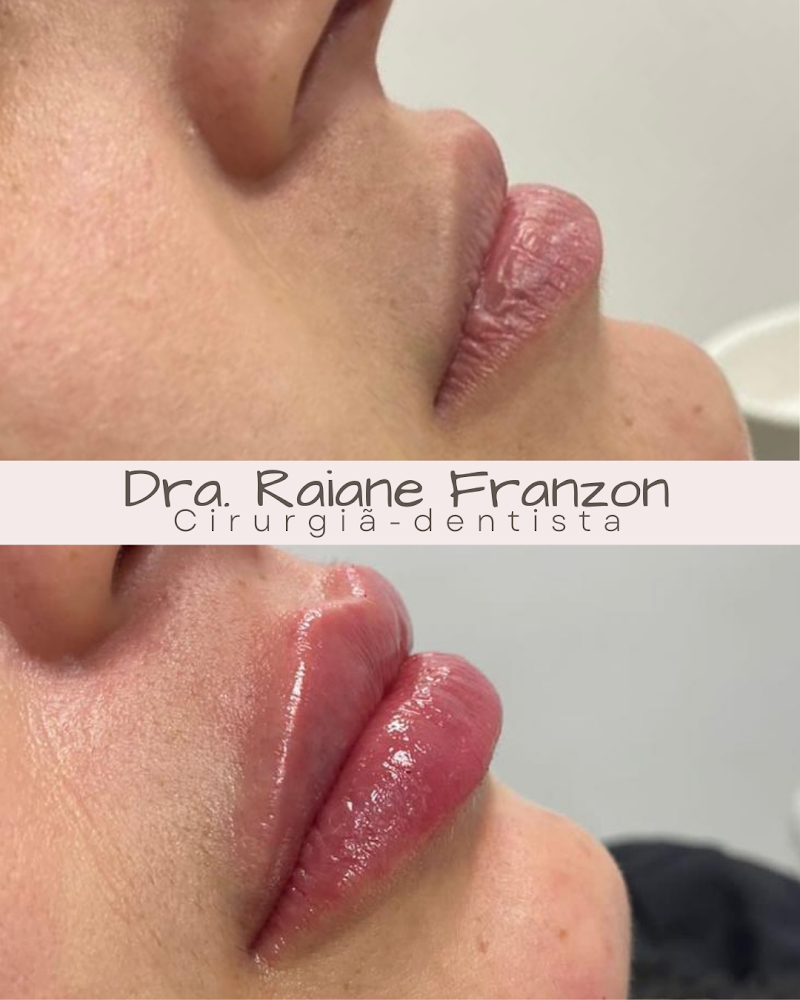 Consultório Odontológico - Dra. Raiane Franzon