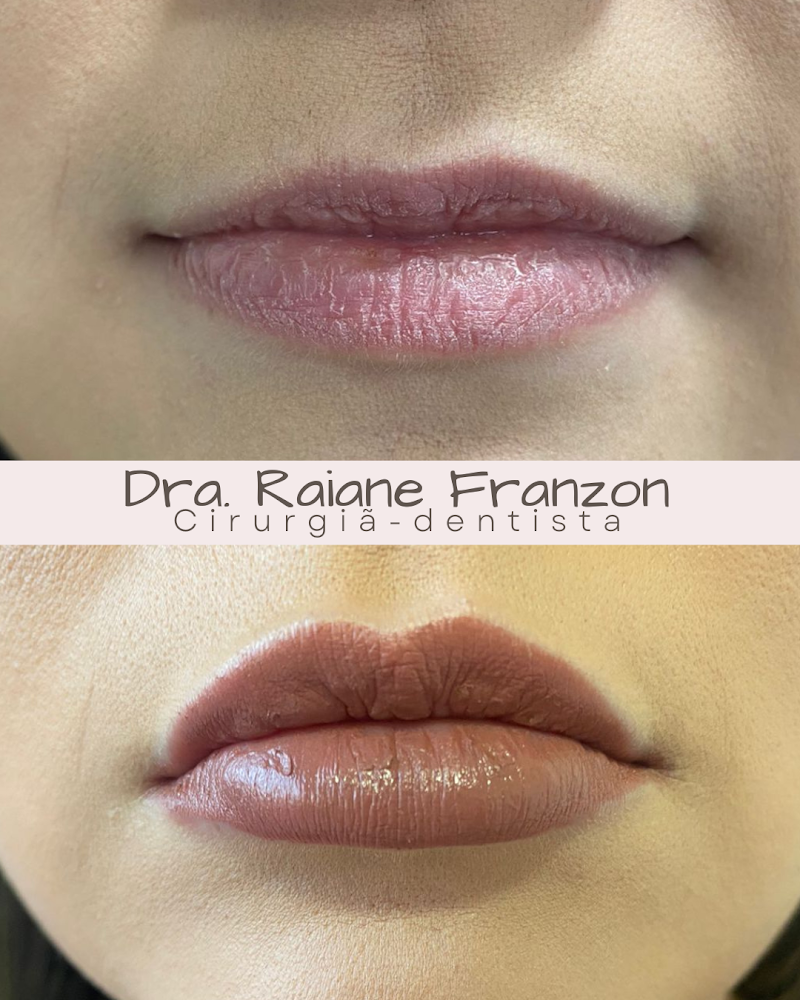 Consultório Odontológico - Dra. Raiane Franzon - foto 4