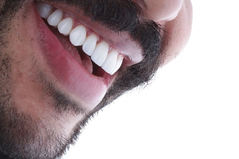 Odonto Armoni I Especialista em Lentes de Contato Dental | Implantes | Ortodôntia - foto 4