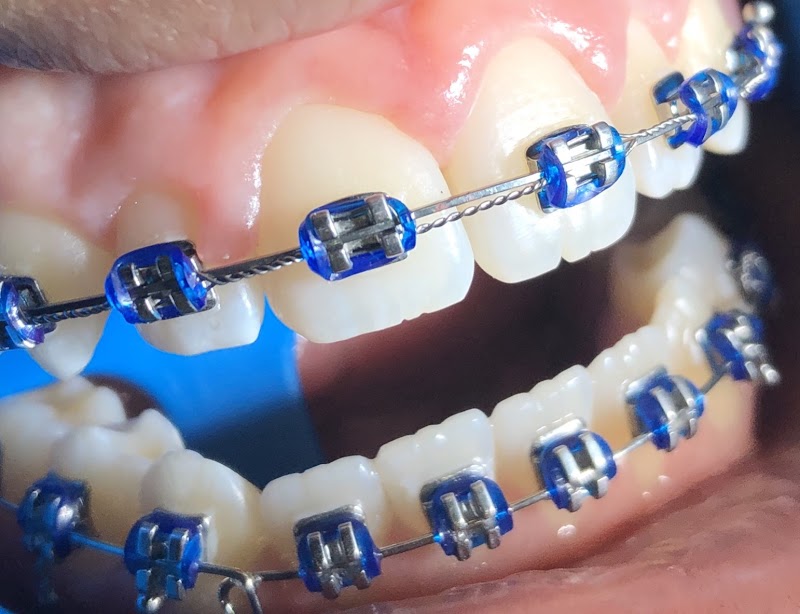 Dra. Julia Garcia Costa - Ortodontista - foto 5