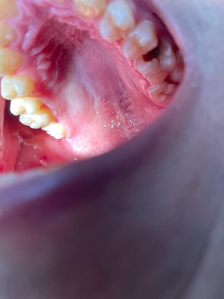 DENTISTA 24HS/ Clínica odontológica/ Urgência odontológica/ dentista Florianópolis/ consultório odontológico. - foto 5